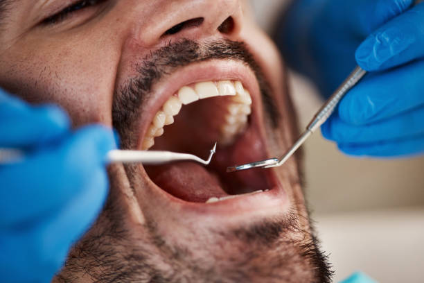 Best Emergency Dentist for Knocked-Out Tooth in Bowling Green, OH